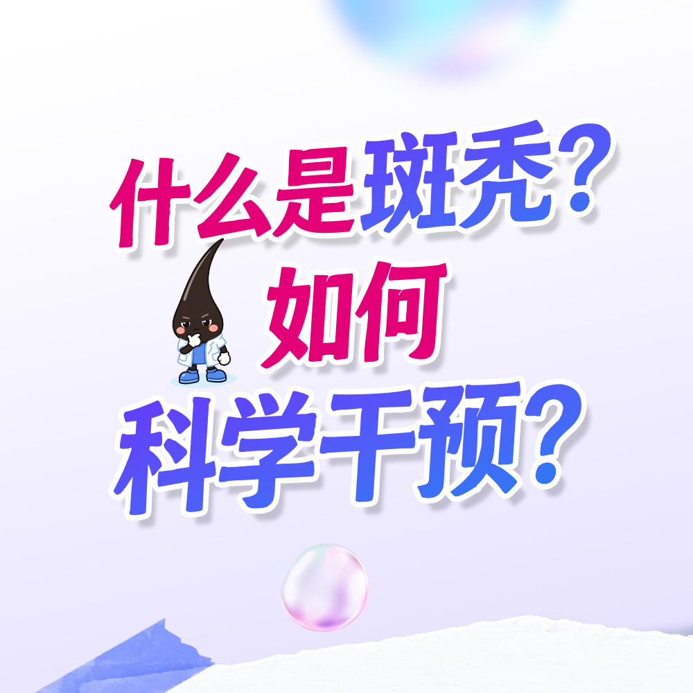 什么是斑秃?如何科学干预?